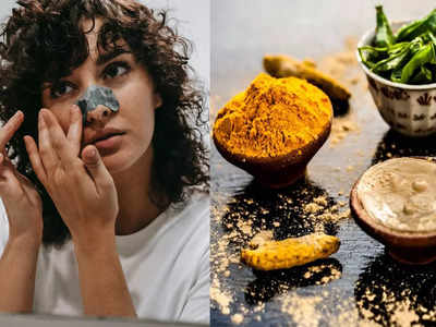 Blackheads Home Remedies: পার্লার যেতে হবে না, এই সহজ ঘরোয়া টোটকায় ব্ল্যাকহেডস তুলুন বাড়িতেই...