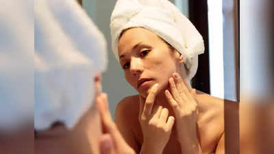 <strong>Pimples Home Remedies : </strong>पिंपल्समुळे चेह-यावर पडलेले खड्डे व काळे डाग होतील दूर, फक्त 10 दिवस ट्राय करा ‘हे’ उपाय..!