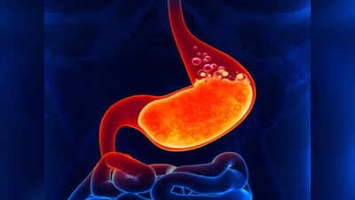 acidity problem: வெயில் காலத்தில் வாயுத்தொல்லை அதிகம் ஏற்படுவது ஏன்... எப்படி தடுக்கலாம்...