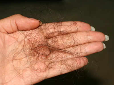 Hair Care Mistakes: इस वजह से कंघी करते ही झड़ रहे हैं आपके बाल, बाकी के 4 कारण भी हैं इसके लिए जिम्मेदार