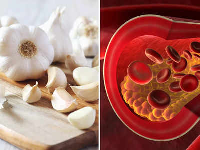 Garlic For Cholesterol: কোলেস্টেরল বাড়লে কি ওষুধ ভরসা? এই উপায়ে রসুন খান, একদিনেই দূর হবে ১০%!