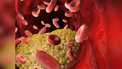 Cholesterol: Heart Attack-এর ঝুঁকি কমাতে নিয়ন্ত্রণ করুন কোলেস্টেরল, পুষ্টিবিদের থেকে জেনে নিন সহজ উপায়...