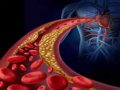 रक्तवाहिन्यांमध्ये कोलेस्ट्रॉल जमा झाल्यास येईल हार्ट अटॅक, करा न्युट्रिशनिस्टने सांगितलेले ‘हे’ 5 स्वस्त व रामबाण उपाय..!