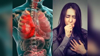 Tuberculosis : टीबी के मरीजों को गोद लेने की पहल शुरू करेगी सरकार, 2025 तक बीमारी को खत्म करने का लक्ष्य