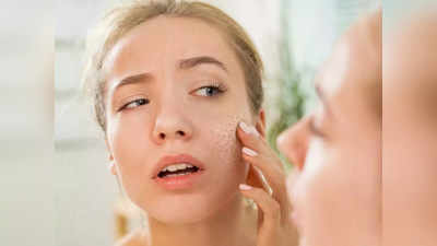 Skin Care Tips : या चुकांकडे दुर्लक्ष केलंत तर त्वचा रूक्ष झालीच म्हणून समजा, आताच सावध व्हा