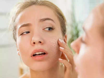 Skin Care Tips : या चुकांकडे दुर्लक्ष केलंत तर त्वचा रूक्ष झालीच म्हणून समजा, आताच सावध व्हा