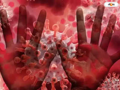 Monkeypox Virus: করোনার পর আতঙ্ক ছড়াচ্ছে মাঙ্কিপক্স ভাইরাস, সংক্রমণ আমেরিকাতেও