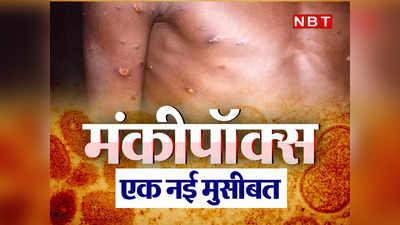 Monkeypox News : कई देशों में फैला मंकीपॉक्स, समलैंगिकों को ज्यादा खतरा, क्या भारतीयों को चिंता करने की जरूरत है?