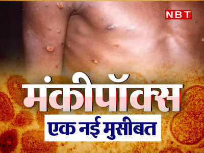 Monkeypox News : कई देशों में फैला मंकीपॉक्स, समलैंगिकों को ज्यादा खतरा, क्या भारतीयों को चिंता करने की जरूरत है?