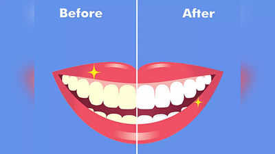 दांतों के पीलेपन को साफ करके सफेदी वाली बत्तीसी दे सकते हैं ये पाउडर, देखें ये 5 ऑप्शन