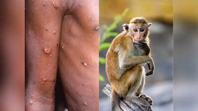 भयंकर हुआ Monkeypox, WHO की चेतावनी-12 देशों में फैला, 8 लक्षणों को न करें नजरअंदाज