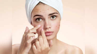 acne  : முகப்பரு... தழும்பு ஆகாம குணப்படுத்த என்னென்ன எசென்ஷியல் ஆயில் யூஸ் பண்ணலாம்? ஆய்வு சொல்வது என்ன?