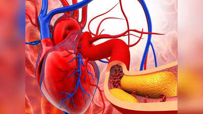 Cholesterol remedies: आज से छोड़ दें 4 बुरी आदतें, खून की एक-एक नस होगी साफ, बाहर निकलेगा गंदा कोलेस्ट्रॉल