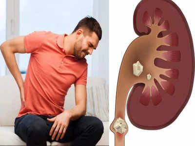 Kidney Stone: अगर भीषण गर्मी में पी रहे हैं कम पानी तो खतरे में है किडनी! डॉ. ने बताया कैसे बचें