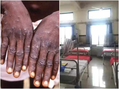 Monkeypox threat: కలవరపెడుతున్న మంకీపాక్స్.. ముంబైలో 28 పడకల ఐసోలేషన్ వార్డ్