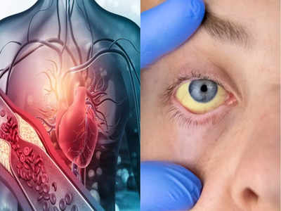 Heart Attack symptoms: सीने में दर्द-सांस की कमी से अलग चेहरे पर ही दिख सकते हैं हार्ट अटैक के 3 गंभीर संकेत