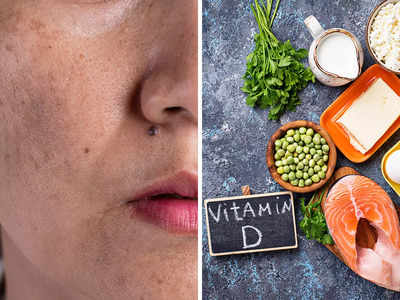 Vitamin D Deficiency: ভিটামিনের অভাবে লাবণ্য হারাচ্ছে আপনার ত্বক? এই 8টি জিনিস অবশ্যই খান...