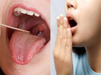 Bad breath remedies: दांत-मसूड़ों में चिपके सारा मैल निकाल देंगे ये 5 उपाय, कभी नहीं आएगी मुंह से बदबू