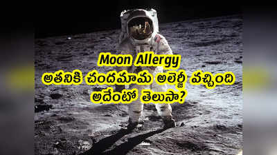 Moon Allergy: అతనికి చందమామ అలెర్జీ వచ్చింది.. అదేంటో తెలుసా?