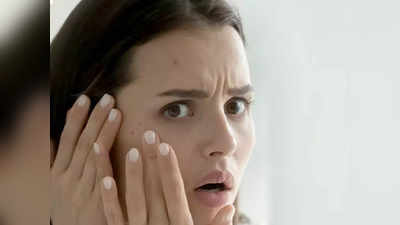 इन Face Wash से पिंपल्स और एक्ने की प्रॉब्लम हो सकती है कम, त्वचा को दें बढ़िया ग्लो