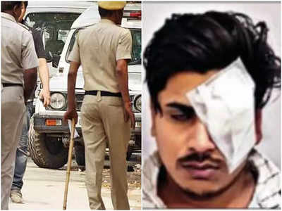 पुलिस ने कार पर मारा डंडा तो युवक की आंख में घुस गया कांच का टुकड़ा, करानी पड़ी सर्जरी