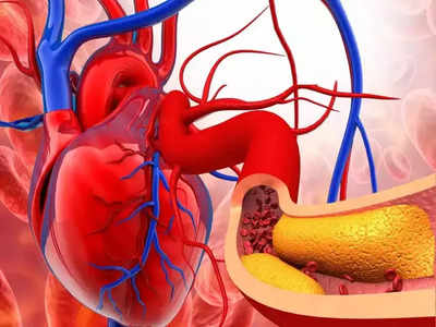 Cholesterol remedies: તમારી લોહીની નસો સાફ કરવા માટે આજે જ છોડો આ 4 આદતો, બહાર નિકળશે ખરાબ કોલેસ્ટ્રોલ 