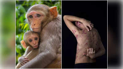 Monkeypox Virus: করোনার মতো দ্রুত ছড়াচ্ছে মাঙ্কিপক্স! CDC জানাল বাঁচার ৫ উপায়