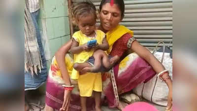 चार हाथ-पांव वाली बच्‍ची को इलाज के लिए तलाश रहीं सिविल सर्जन, सोनू सूद ने भी किया था मदद का वादा