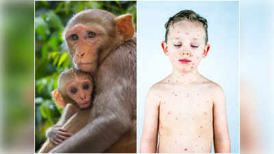 Monkeypox Virus: ছোটদের বড় বিপদের কারণ হতে পারে মাঙ্কিপক্স! লক্ষণ নিয়ে সতর্ক করল ICMR