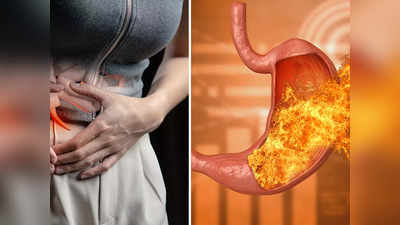 Home Remedies For Heartburn: অ্যাসিডিটির ভয়ে ভালো-মন্দ খাবার খেতে ভয়? ঘরোয়া এই ৭ উপায়ে মিলবে সমাধান!