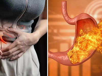 Home Remedies For Heartburn: অ্যাসিডিটির ভয়ে ভালো-মন্দ খাবার খেতে ভয়? ঘরোয়া এই ৭ উপায়ে মিলবে সমাধান!