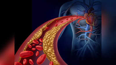 Cholesterol: রক্তে কোলেস্টেরলের কতটা থাকলে দূরে থাকে Stroke, Heart Attack? জানুন চিকিৎসকের মুখে