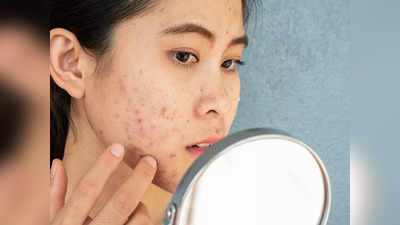 Best Acne Treatment: জল কম খান? ত্বকের জন্য কতটা ক্ষতি করছেন, চিকিৎসকের থেকে জেনে নিন...
