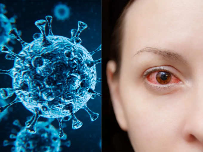 मंकीपॉक्स और कोरोना वायरस कैसे अलग हैं?