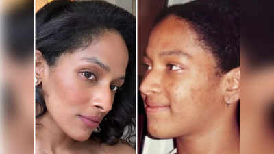 Masaba Gupta on Acne: 12 साल की उम्र में मसाबा गुप्ता नहीं देखना चाहती थीं शीशा, थ्रोबैक फोटो शेयर कर बताई वजह