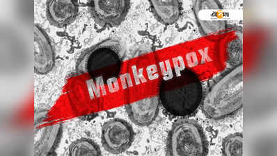 দেশে প্রথম Monkey Pox-এর থাবা! উত্তরপ্রদেশে শিশুর শরীরে একাধিক উপসর্গ!!