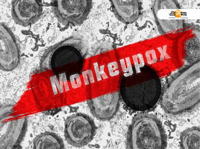 দেশে প্রথম Monkey Pox-এর থাবা! উত্তরপ্রদেশে শিশুর শরীরে একাধিক উপসর্গ!!