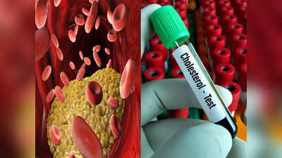 Cholesterol test: ये टेस्ट बताएगा नसों में भर चुका है गंदा कोलेस्ट्रॉल, हार्ट अटैक से बचना है तो 25 की उम्र जरूर करा लें