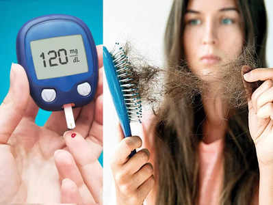 Hair Loss Diabetes:  சர்க்கரை நோயாளிகளுக்கு முடி உதிர்வு அதிகமாக இருக்கும்.. எப்படி தவிர்ப்பது!