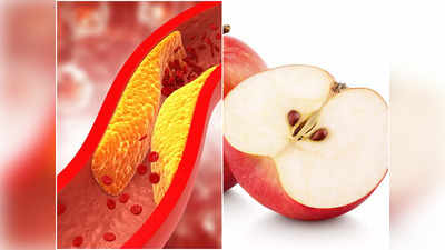 Cholesterol: শরীর থেকে কোলেস্টেরল টেনে বের করে দেবে এই ৫ সুপারফুড! জানুন চিকিৎসকের থেকে