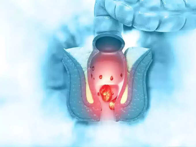 कॅन्सरचे औषध Dostarlimab ची किंमत काय आहे?