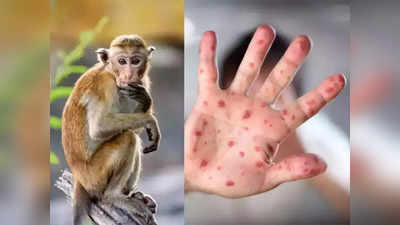 Monkeypox Transmission : हवेमार्फत पसरतोय मंकीपॉक्स व्हायरस, WHO ची चेतावणी, आता धोका वाढतोय