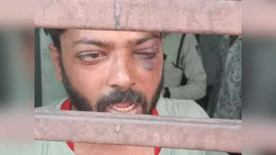 Indore News : नशामुक्ति केंद्र में युवक के साथ मारपीट, बंधक बनाकर बेरहमी से पीटा