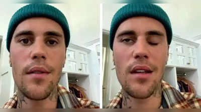 Justin Bieber Paralysis: जस्टिन बीबर का आधा चेहरा हो गया पैरालिसिस का श‍िकार, वायरस की वजह से हुई ऐसी हालत