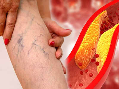 Clogged arteries symptoms: 5 બોડી પાર્ટ્સમાં દુખાવાનો અર્થ થાય કે ગંદકીથી લોહીની નસો બંધ થઇ છે, તરત આ બે કામ કરો