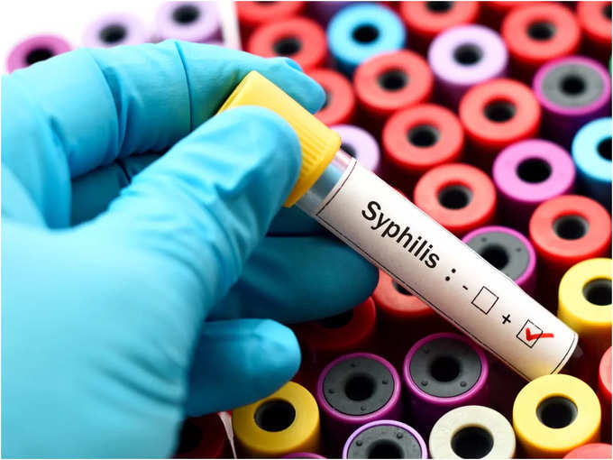 ಸಿಫಿಲಿಸ್ ಅಥವಾ Syphilis