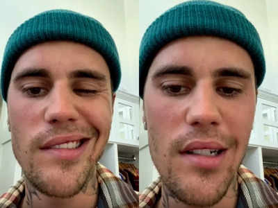Justin Bieber : వరల్డ్ ఫేమస్ సింగర్‌కు పక్షవాతం.. జస్టిన్ బీబర్ మొహంలో వచ్చిన మార్పులివే