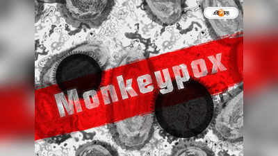 Monkeypox Virus Outbreak: লক্ষণ বোঝা দায়! মাঙ্কিপক্স নিয়ে উদ্বিগ্ন বিশেষজ্ঞরা