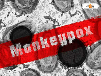 Monkeypox Virus Outbreak: লক্ষণ বোঝা দায়! মাঙ্কিপক্স নিয়ে উদ্বিগ্ন বিশেষজ্ঞরা