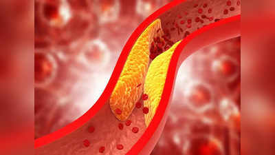high cholesterol: இந்த 5 இடத்தில் வலி இருந்தால் உடம்பில் கொலஸ்டிரால் அதிகமா இருக்குனு அர்த்தமாம்...